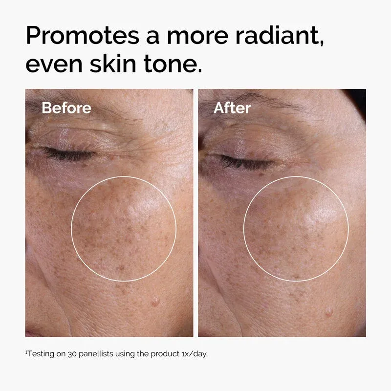ord-glycolic-before-after-radiance (1).webp