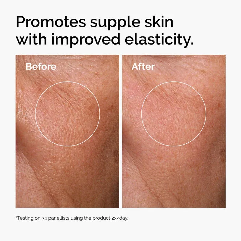 ord-hyaluronic-acid-2pct-b5-hydrating-serum-before-after-elasticity (1).webp
